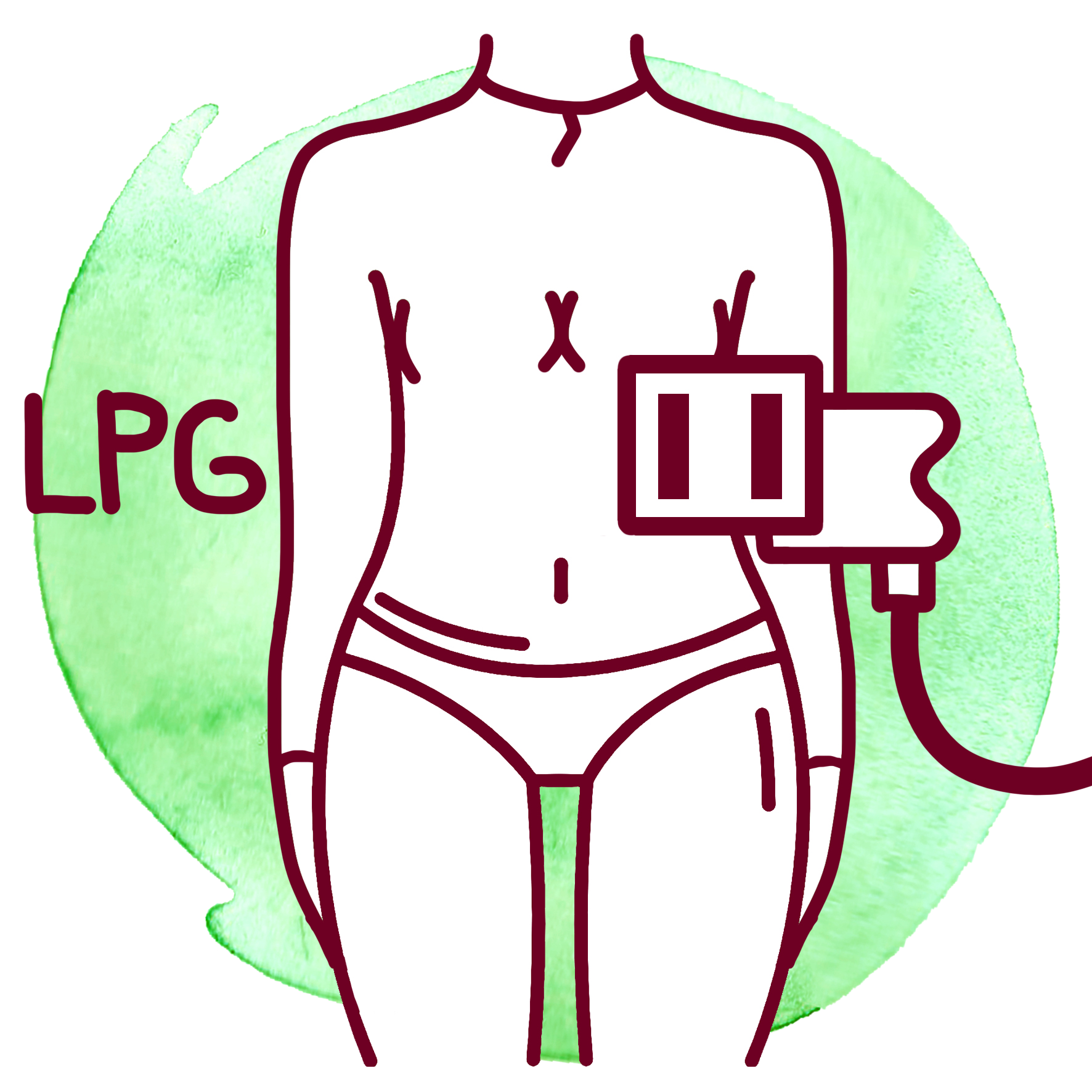 LPG массаж (липомассаж)