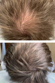 rehair cover 180x270 - ReHair: лечение волос и кожи головы